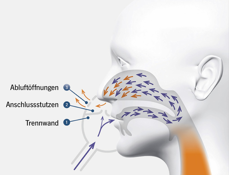 patentierte-Technologie-der-F&P-OptiNIV
